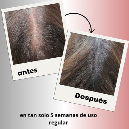 PeloZen™ | Peine eléctrico para masaje del cuero cabelludo y aplicador de aceite